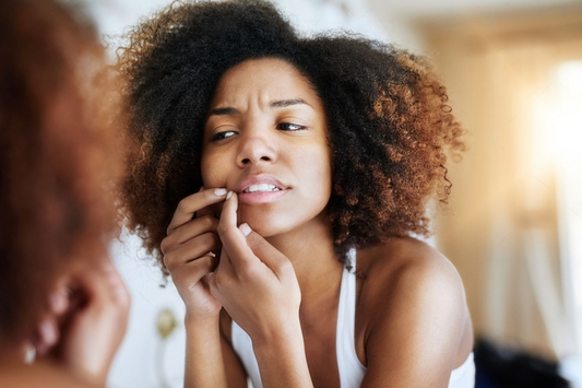 Femme, miroir et l'acné avec des soins de la peau à la maison avec une éruption de boutons, problème de peau et frustré. 